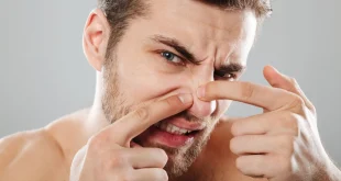 4 Bahan Alami yang Dapat Membantu Mengatasi Jerawat di Area Hidung dengan Cepat