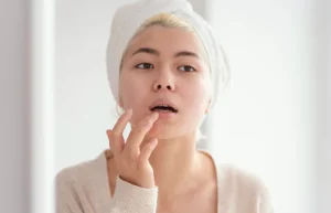 5 Cara Merawat Bibir Kusam dan Menghitam agar Lebih Sehat