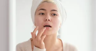 5 Cara Merawat Bibir Kusam dan Menghitam agar Lebih Sehat