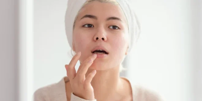 5 Cara Merawat Bibir Kusam dan Menghitam agar Lebih Sehat