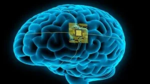 China Tanam Chip Otak Komersial Pertama di Dunia, Membuka Era Baru dalam Neuroteknologi