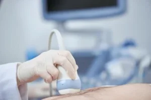 Dokter Ungkap USG 2D Bisa Deteksi Kelainan Janin Kalahkan 4D: Fakta Menarik Tentang Pemeriksaan Kehamilan