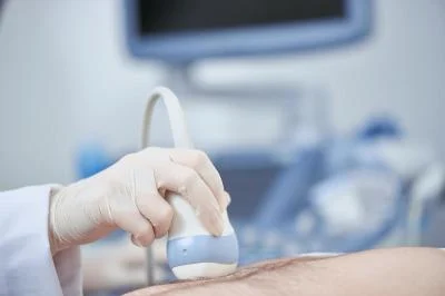 Dokter Ungkap USG 2D Bisa Deteksi Kelainan Janin Kalahkan 4D: Fakta Menarik Tentang Pemeriksaan Kehamilan
