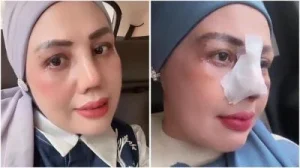 Elly Sugigi Tanggapi Sindiran Anak Terkait Oplas dan Mobil: Kerja Keras untuk Masa Depan