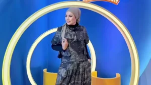 Elly Sugigi Terlihat Lebih Cantik Setelah Operasi Plastik, Mirip Natasha Wilona