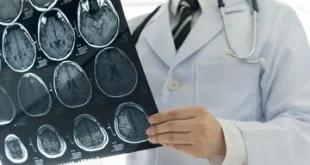 Golongan Darah A Membawa Risiko Tinggi Stroke di Usia Muda