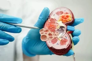 Menahan Kencing Bisa Rusak Ginjal Ternyata Bukan Mitos, Ini Penjelasan Dokter