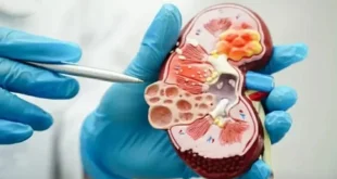 Menahan Kencing Bisa Rusak Ginjal Ternyata Bukan Mitos, Ini Penjelasan Dokter