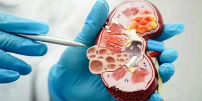 Menahan Kencing Bisa Rusak Ginjal Ternyata Bukan Mitos, Ini Penjelasan Dokter