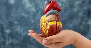 Mengapa Memasang Ring Jantung Tak Selalu Menjadi Solusi? Simak Penjelasan Dokter