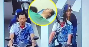 Kondisi Terkini Andrie Yunus Setelah 7 Kali Operasi