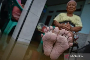 Mengatasi Kaki Gatal Terus? Kenali 5 Penyebab, Cara Mengatasi dan Mencegahnya