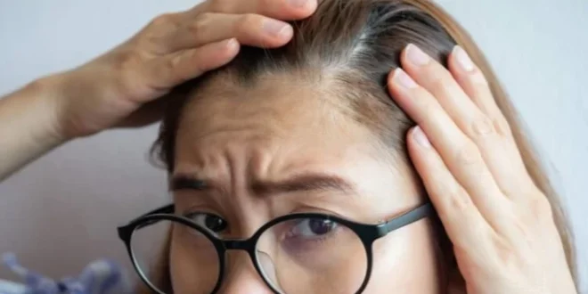Rambut Semakin Tipis? Simak 5 Penyebab Utama dan Cara Mencegahnya