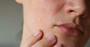 Treatment Estetika Wajah: Kenali Alasan Penting untuk Sesuaikan Perawatan